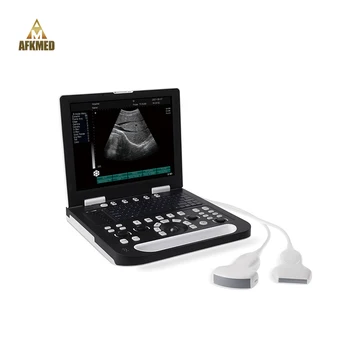Nešiojamų Veterinarijos ultragarso skenerį nėštumo ultragarso ultragarso aparatas
